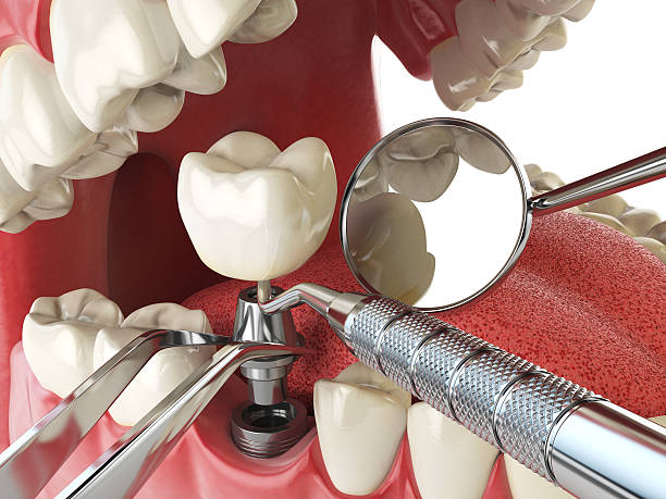Best Emergency Dental Care for Trauma or Injury in Champaign, IL